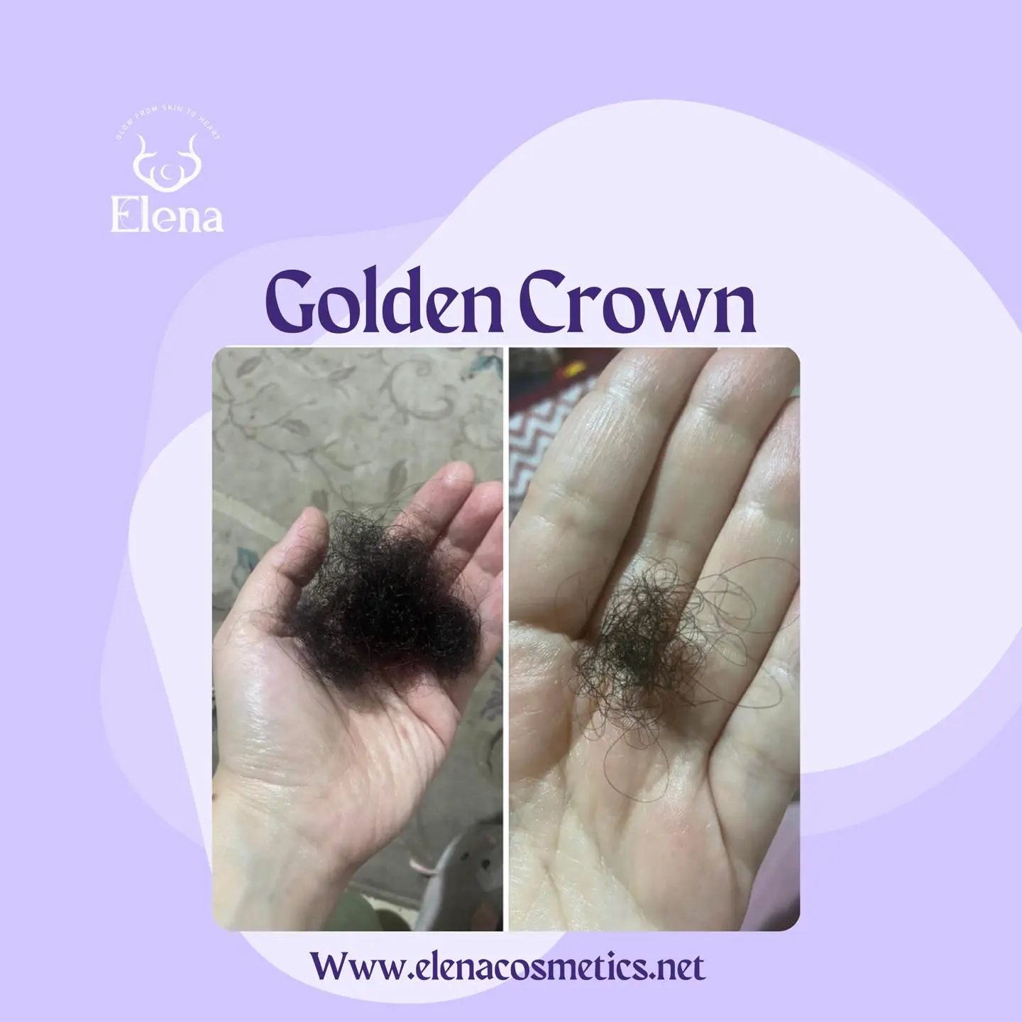 Customer's hands showing before and after results of hair fall reduction using Elena Cosmetics’ Golden Crown Hair Oil – from heavy shedding to visibly less hair loss.