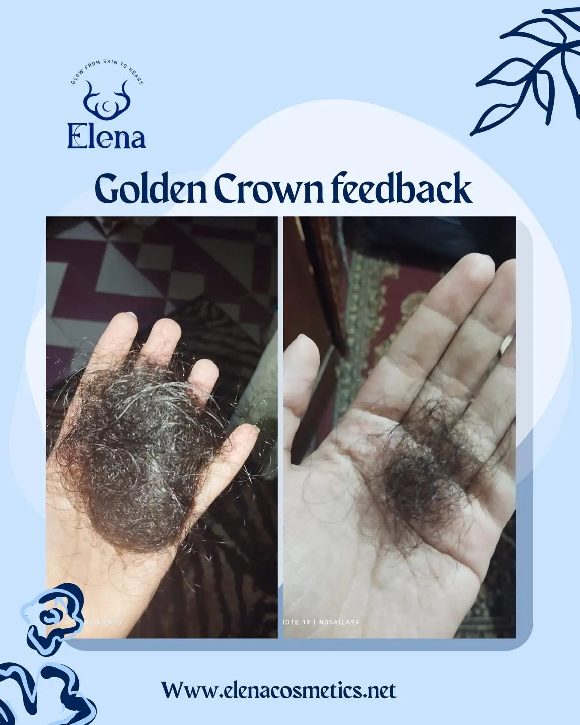 Before and after customer feedback showing reduced hair fall after using Elena Cosmetics Golden Crown Hair Oil for hair growth and root strengthening.