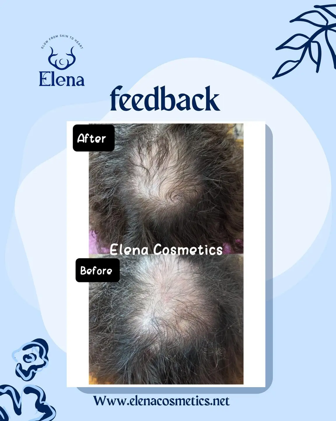Before and after customer feedback showing visible new hair growth and reduced scalp thinning after using Elena Cosmetics Golden Crown Hair Oil for root strengthening.