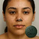 chlorophyll-soap-before-after-acne-prone-skin-elena.webp