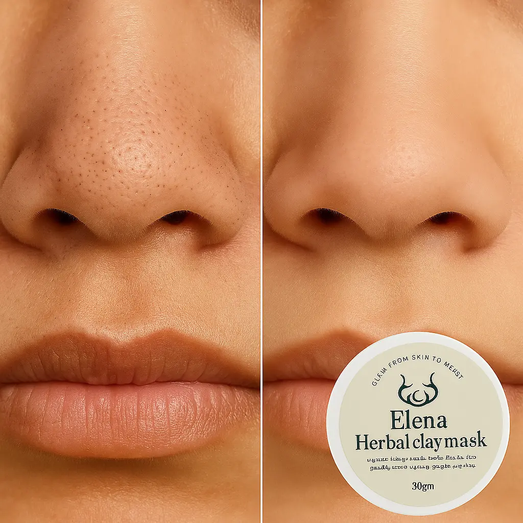 before-after-herbal-clay-mask-blackheads-pores-elena-cosmetics.webp