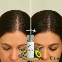before-after-hair-regrowth-golden-crown-arab-woman-elena.webp
