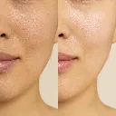 elena-brightening-glow-soap-skin-radiance-before-after.jpg.webp