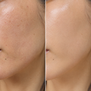 elena-blooming-night-oil-before-after-closeup 1.png